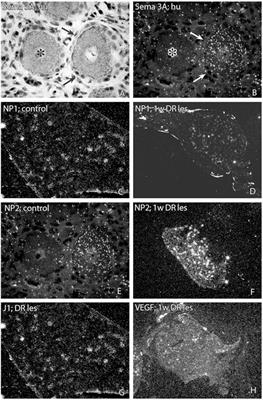 Expression of Semaphorins, Neuropilins, VEGF, and Tenascins in Rat and Human Primary Sensory Neurons after a Dorsal Root Injury